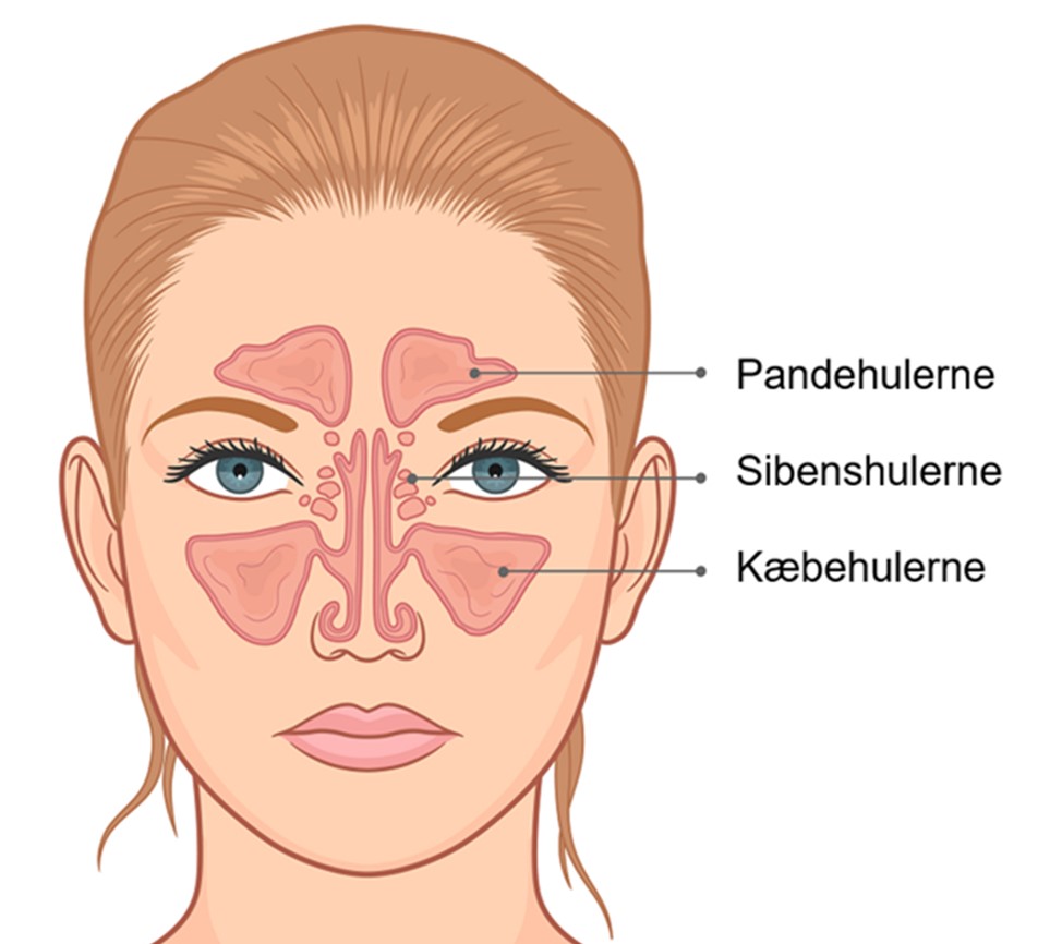 Kronisk bihulebetændelse | Bihulernes | Øre næse halslæge | Alba Privathospital
